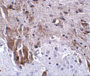 Anti-LRFN1 antibody used in IHC (Paraffin sections) (IHC-P). GTX85345