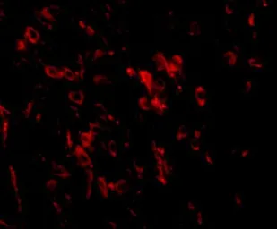 Anti-LRFN1 antibody used in IHC (Paraffin sections) (IHC-P). GTX85345