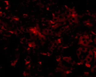 Anti-GNPDA2 antibody used in IHC (Paraffin sections) (IHC-P). GTX85346