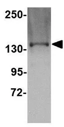 Anti-TTBK1 antibody used in Western Blot (WB). GTX85349