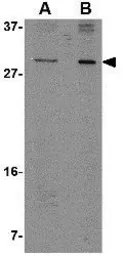 Anti-OCC1 antibody used in Western Blot (WB). GTX85351
