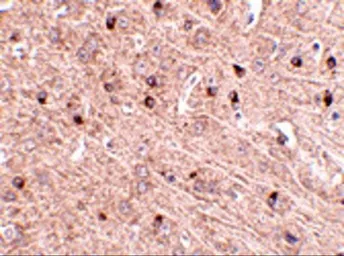 Anti-TOM70 antibody used in IHC (Paraffin sections) (IHC-P). GTX85353