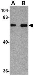 Anti-TOM70 antibody used in Western Blot (WB). GTX85353