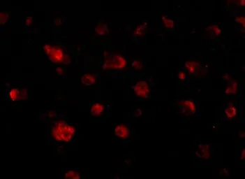 Anti-JPH3 antibody used in IHC (Paraffin sections) (IHC-P). GTX85363