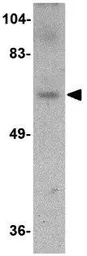 Anti-Dact3 antibody used in Western Blot (WB). GTX85372
