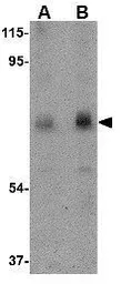 Anti-Calpain 6 antibody used in Western Blot (WB). GTX85383