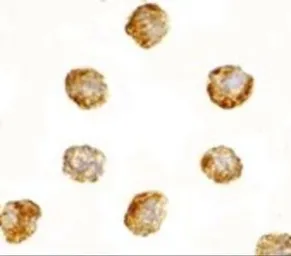 Anti-DNAL1 antibody used in Immunocytochemistry/ Immunofluorescence (ICC/IF). GTX85387