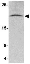Anti-Nanos3 antibody used in Western Blot (WB). GTX85389