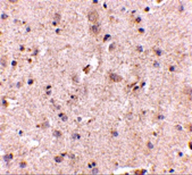 Anti-Dlgap2 antibody used in IHC (Paraffin sections) (IHC-P). GTX85395