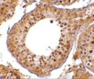 Anti-RGPD5 antibody used in IHC (Paraffin sections) (IHC-P). GTX85402