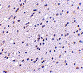 Anti-CAPS2 antibody used in IHC (Paraffin sections) (IHC-P). GTX85405