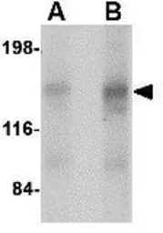Anti-CAPS2 antibody used in Western Blot (WB). GTX85405