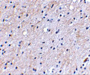 Anti-NIPSNAP antibody used in IHC (Paraffin sections) (IHC-P). GTX85407