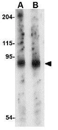 Anti-SLITRK6 antibody used in Western Blot (WB). GTX85411