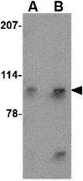 Anti-Slitrk4 antibody used in Western Blot (WB). GTX85415