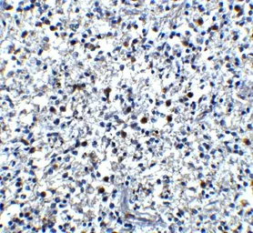 Anti-Cathelicidin antibody used in IHC (Paraffin sections) (IHC-P). GTX85418