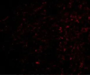 Anti-FNBP1L antibody used in IHC (Paraffin sections) (IHC-P). GTX85424