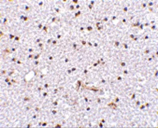 Anti-FNBP1L antibody used in IHC (Paraffin sections) (IHC-P). GTX85425
