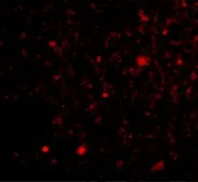 Anti-FNBP1L antibody used in IHC (Paraffin sections) (IHC-P). GTX85425
