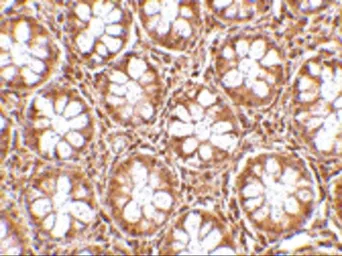 Anti-RASD2 antibody used in IHC (Paraffin sections) (IHC-P). GTX85427