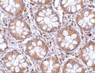 Anti-RASD2 antibody used in IHC (Paraffin sections) (IHC-P). GTX85428