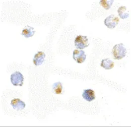 Anti-ORAI2 antibody used in Immunocytochemistry/ Immunofluorescence (ICC/IF). GTX85443