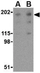 Anti-Nogo A antibody used in Western Blot (WB). GTX85447