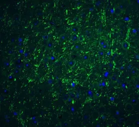 Anti-PD-L2 antibody used in IHC (Paraffin sections) (IHC-P). GTX85449