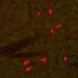 Anti-Choline Acetyltransferase antibody used in IHC (Paraffin sections) (IHC-P). GTX85450