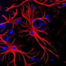 Anti-GFAP antibody used in Immunohistochemistry (IHC). GTX85454