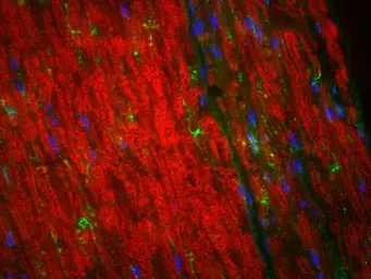Anti-Myelin basic protein antibody used in Immunohistochemistry (IHC). GTX85456