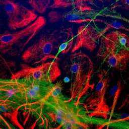 Anti-NSE antibody used in Immunocytochemistry/ Immunofluorescence (ICC/IF). GTX85462