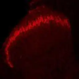 Anti-Prostatic Acid Phosphatase antibody used in IHC (Paraffin sections) (IHC-P). GTX85463