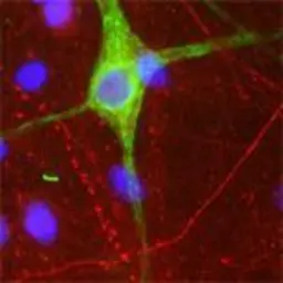 Anti-Peripherin antibody used in Immunocytochemistry/ Immunofluorescence (ICC/IF). GTX85464