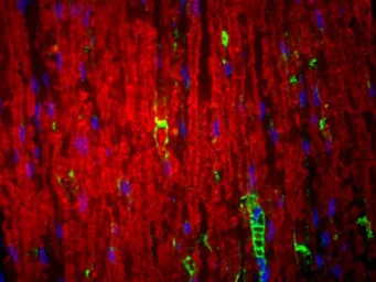 Anti-MPZ antibody used in Immunohistochemistry (IHC). GTX85466