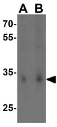 Anti-SCO2 antibody used in Western Blot (WB). GTX85482