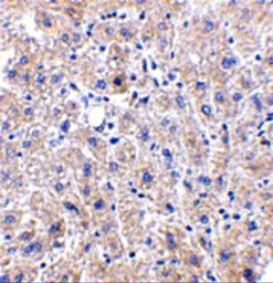 Anti-DRAM antibody used in IHC (Paraffin sections) (IHC-P). GTX85484