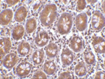 Anti-PTRH2 antibody used in IHC (Paraffin sections) (IHC-P). GTX85497
