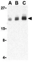 Anti-PTRH2 antibody used in Western Blot (WB). GTX85497