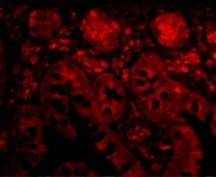 Anti-PTRH2 antibody used in IHC (Paraffin sections) (IHC-P). GTX85497