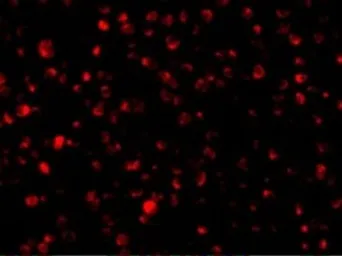 Anti-PTRH2 antibody used in Immunocytochemistry/ Immunofluorescence (ICC/IF). GTX85498