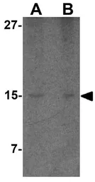 Anti-Precerebellin antibody used in Western Blot (WB). GTX85499