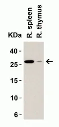 Anti-MD2 antibody used in Western Blot (WB). GTX85517