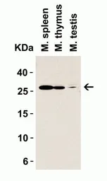 Anti-MD2 antibody used in Western Blot (WB). GTX85517