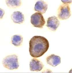 Anti-PERP antibody used in Immunocytochemistry/ Immunofluorescence (ICC/IF). GTX85520