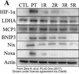 Anti-Noxa antibody used in Western Blot (WB). GTX85521