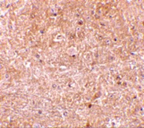 Anti-Caspase 13 antibody used in IHC (Paraffin sections) (IHC-P). GTX85523