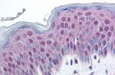 Anti-HMG14 (phospho Ser20/Ser24) antibody used in IHC (Paraffin sections) (IHC-P). GTX85600