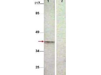 Anti-Aurora B (phospho Thr232) antibody used in Western Blot (WB). GTX85607