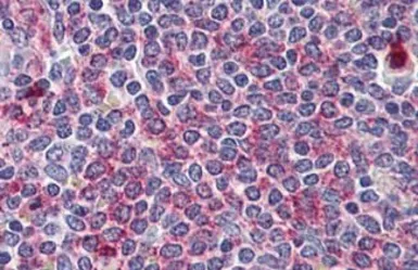 Anti-Wnt5b antibody used in IHC (Paraffin sections) (IHC-P). GTX85688